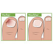 Akcesorium do pedicure