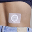 10 magnetických náplastí 500 gaussů
